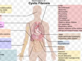 how does cystic fibrosis affect the body