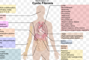 how does cystic fibrosis affect the body